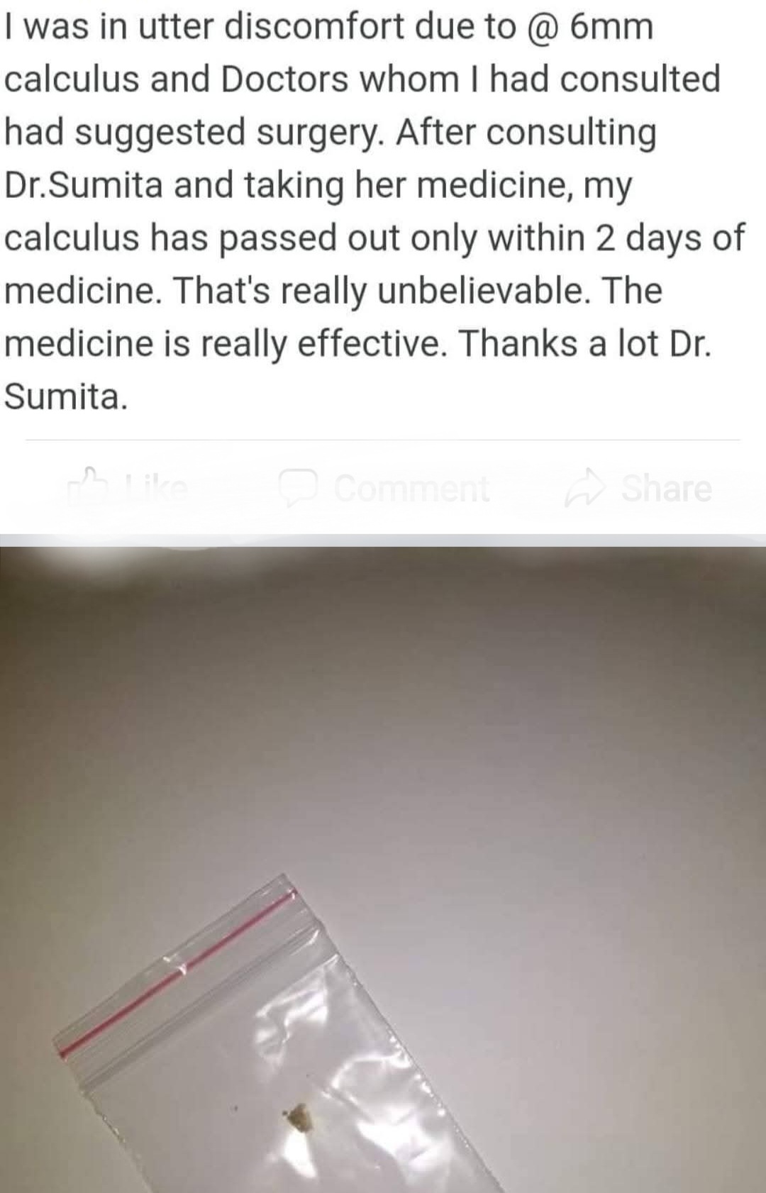 Passed Kidney stone without operation